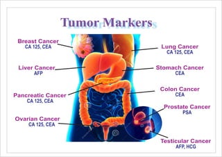 Breast Cancer
CA 125, CEA Lung Cancer
CA 125, CEA
Liver Cancer
AFP
Stomach Cancer
CEA
Pancreatic Cancer
CA 125, CEA
Colon Cancer
CEA
Testicular Cancer
AFP, HCG
Ovarian Cancer
CA 125, CEA
Prostate Cancer
PSA
Tumor Markers
 