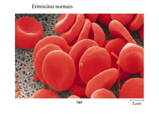 Eritrócitos normais
 