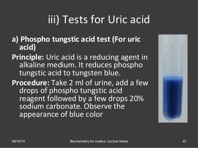 Urinalysis- Methods, observations and clinical significance