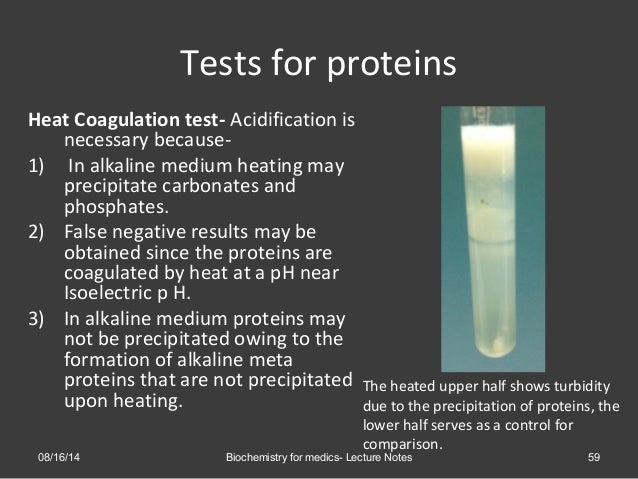 blood sugar test procedure the and clinical observations Urinalysis Methods, significance blood sugar test procedure the and clinical observations Urinalysis Methods, significance
