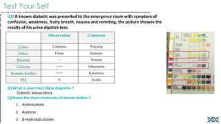 Observation Comment
Color Colorless Polyuria
Odor Fruity Ketones
Protein - Normal
Glucose +++ Glucosuria
Ketone bodies +++ Ketonuria
PH 6 Acidic
Q1) A known diabetic was presented to the emergency room with symptom of
confusion, weakness, fruity breath, nausea and vomiting, the picture showes the
results of his urine dipstick test:
Q) What is your most likely diagnosis ?
Diabetic ketoacidosis.
Q) Name the three molecules of ketone bodies ?
1. Acetoacetate .
2. Acetone .
3. β-Hydroxybutyrate.
Test Your Self
 