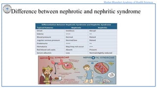 Madan Bhandari Academy of Health Sciences
Difference between nephrotic and nephritic syndrome
 