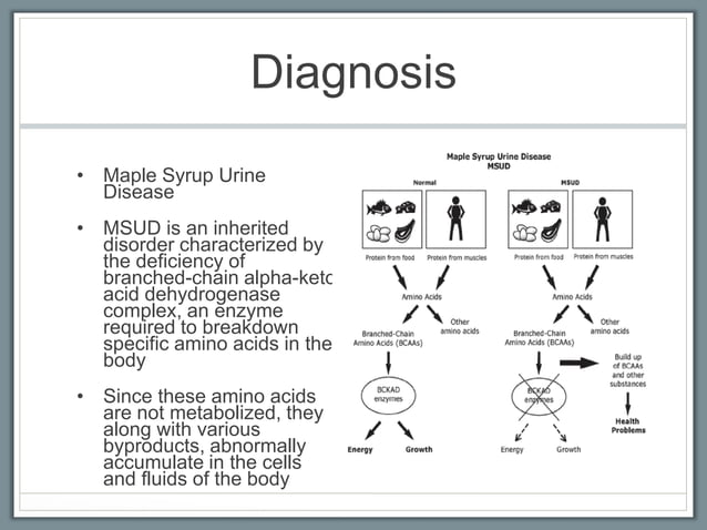 Maple Syrup Urine Disease | PPTX