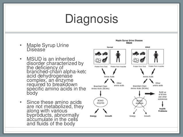 maple syrup urine disease statistics maple syrup urine disease statistics