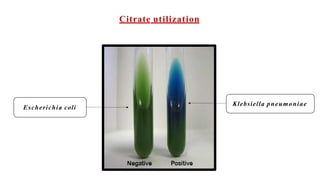 Klebsiella pneumoniae
Escherichia coli
Citrate utilization
 