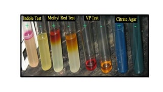 biochimical test_Converted for med lab tech.pptx