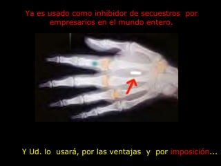 Y Ud. lo  usará, por las ventajas  y  por  imposición ...  Ya es usado como inhibidor de secuestros  por empresarios en el mundo entero. 