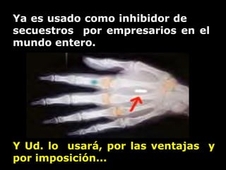 Y Ud. lo  usará, por las ventajas  y  por imposición...  Ya es usado como inhibidor de  secuestros  por empresarios en el mundo entero. 