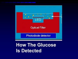 How The Glucose
Is Detected
 