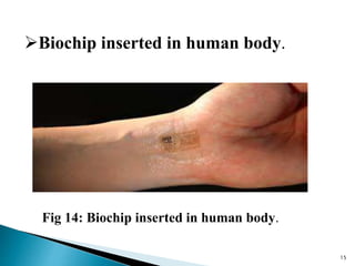 Bio chips | PPT