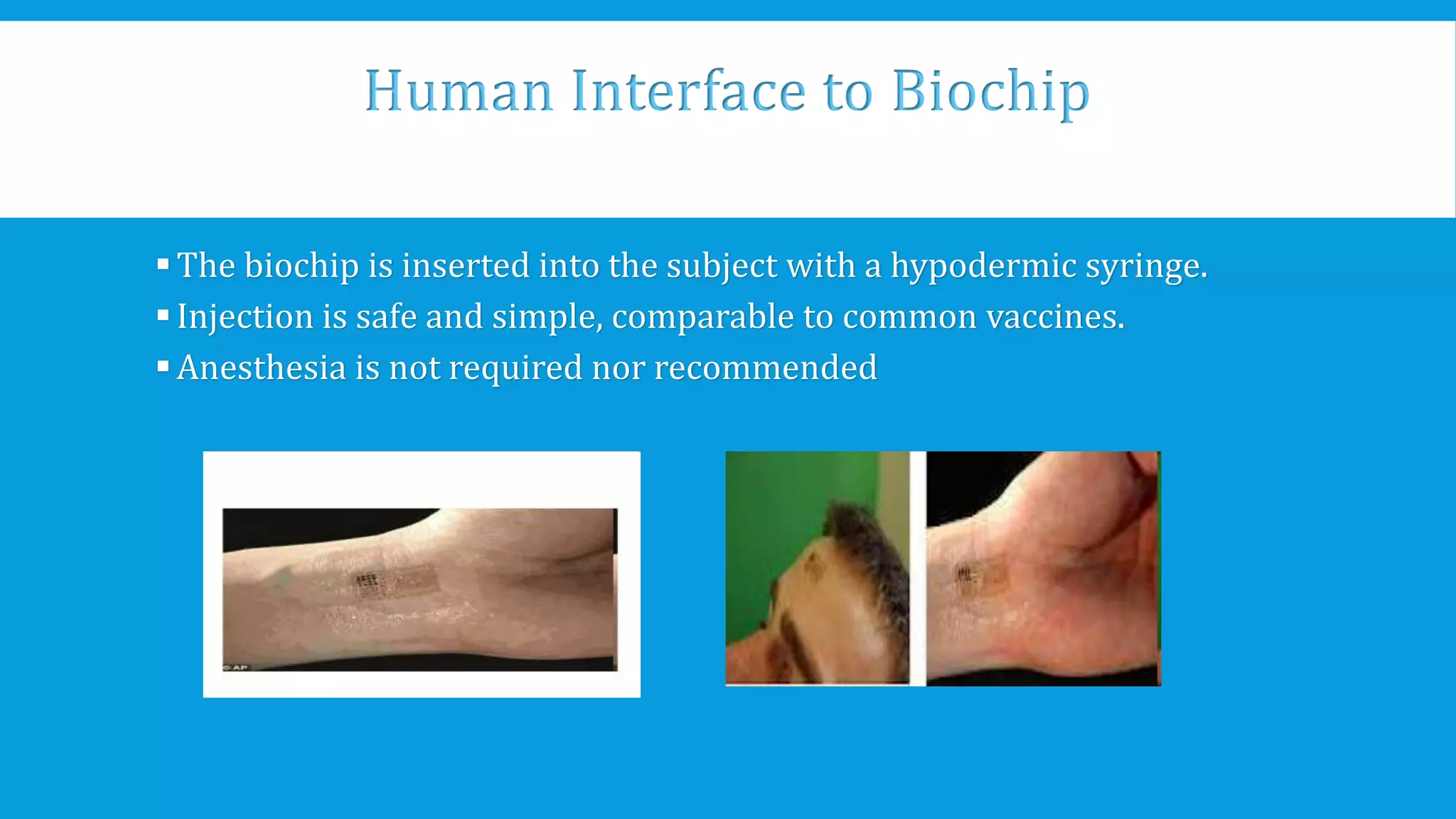 Human Interface to Biochip
The biochip is inserted into the subject with a hypodermic syringe.
Injection is safe and simple, comparable to common vaccines.
Anesthesia is not required nor recommended
 