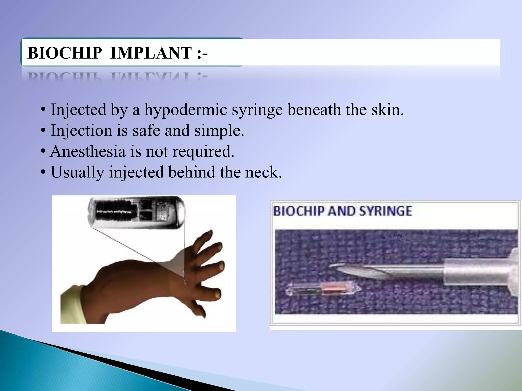 BIOCHIP IMPLANT :-


 • Injected by a hypodermic syringe beneath the skin.
 • Injection is safe and simple.
 • Anesthesia is not required.
 • Usually injected behind the neck.
 