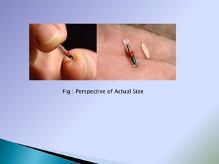 Fig : Perspective of Actual Size
 