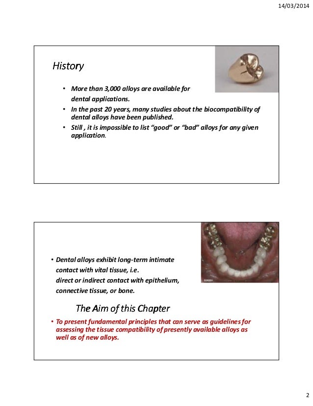 of dental alloys
