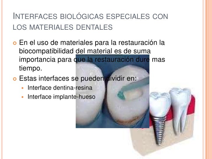 en materiales