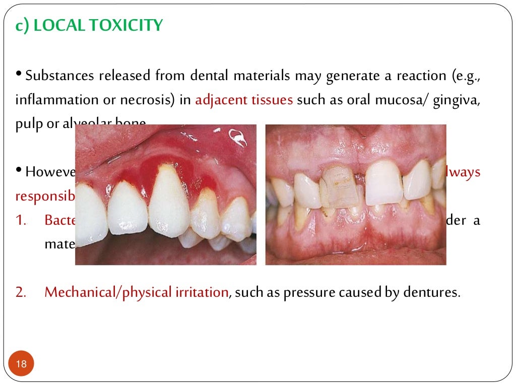 of dental materials