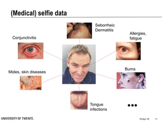 (Medical) selfie data
19-Apr-18 11
Seborrheic
Dermatitis
Allergies,
fatigueConjunctivitis
Moles, skin diseases
Burns
Tongue
infections
 
