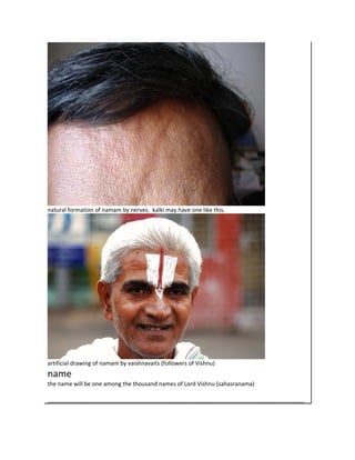 natural formation of namam by nerves. kalki may have one like this.




artificial drawing of namam by vaishnavaits (followers of Vishnu)
name
the name will be one among the thousand names of Lord Vishnu (sahasranama)

_________________________________________________________________________________
 