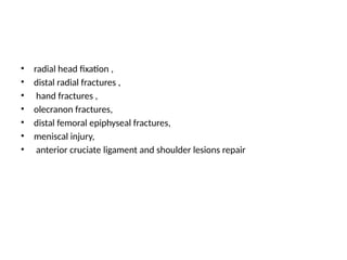 • radial head fixation ,
• distal radial fractures ,
• hand fractures ,
• olecranon fractures,
• distal femoral epiphyseal fractures,
• meniscal injury,
• anterior cruciate ligament and shoulder lesions repair
 