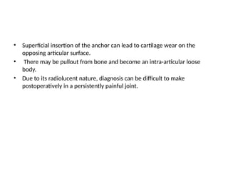 • Superficial insertion of the anchor can lead to cartilage wear on the
opposing articular surface.
• There may be pullout from bone and become an intra-articular loose
body.
• Due to its radiolucent nature, diagnosis can be difficult to make
postoperatively in a persistently painful joint.
 