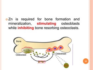  Zn is required for bone formation and
mineralization, stimulating osteoblasts
while inhibiting bone resorbing osteoclasts.
35
 
