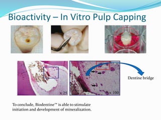 Bioactivity – In Vitro Pulp Capping
To conclude, Biodentine™ is able to stimulate
initiation and development of mineralization.
Dentine bridge
 
