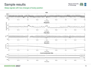 Sample results
Sleep signals with two changes of body position
14
 