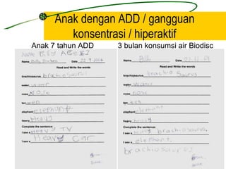 Anak dengan ADD / gangguan
        konsentrasi / hiperaktif
Anak 7 tahun ADD   3 bulan konsumsi air Biodisc
 