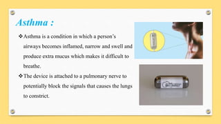Asthma :
Asthma is a condition in which a person’s
airways becomes inflamed, narrow and swell and
produce extra mucus which makes it difficult to
breathe.
The device is attached to a pulmonary nerve to
potentially block the signals that causes the lungs
to constrict.
 