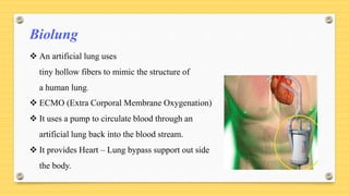 Biolung
 An artificial lung uses
tiny hollow fibers to mimic the structure of
a human lung.
 ECMO (Extra Corporal Membrane Oxygenation)
 It uses a pump to circulate blood through an
artificial lung back into the blood stream.
 It provides Heart – Lung bypass support out side
the body.
 