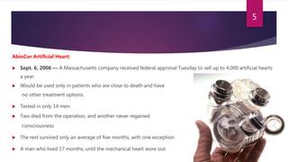 .
AbioCor Artificial Heart:
 Sept. 6, 2006 — A Massachusetts company received federal approval Tuesday to sell up to 4,000 artificial hearts
a year.
 Would be used only in patients who are close to death and have
no other treatment options.
 Tested in only 14 men.
 Two died from the operation, and another never regained
consciousness
 The rest survived only an average of five months, with one exception.
 A man who lived 17 months, until the mechanical heart wore out.
5
 