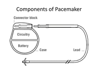 Pacemaker Hardware Bioelectronics devices | PPTX