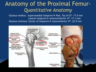Anatomy of the Proximal Femur-
Quantitative Anatomy
Gluteus medius: Superomedial footprint Post. Tip of GT- 17.0 mm
Lateral footprint anteriorinferior VT- 17.1 mm
Gluteus minimus: Center of footprint anteroinferior VT- 22.9 mm
 