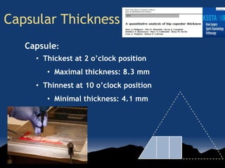 Capsular Thickness
Capsule:
• Thickest at 2 o’clock position
• Maximal thickness: 8.3 mm
• Thinnest at 10 o’clock position
• Minimal thickness: 4.1 mm
 