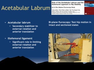 Acetabular Labrum
• Acetabular labrum
• Secondary stabilizer to
external rotation and
anterior translation
• Iliofemoral ligament
• Significant role in limiting
external rotation and
anterior translation
Bi-plane fluroscopy: Test hip motion in
intact and sectioned states
 