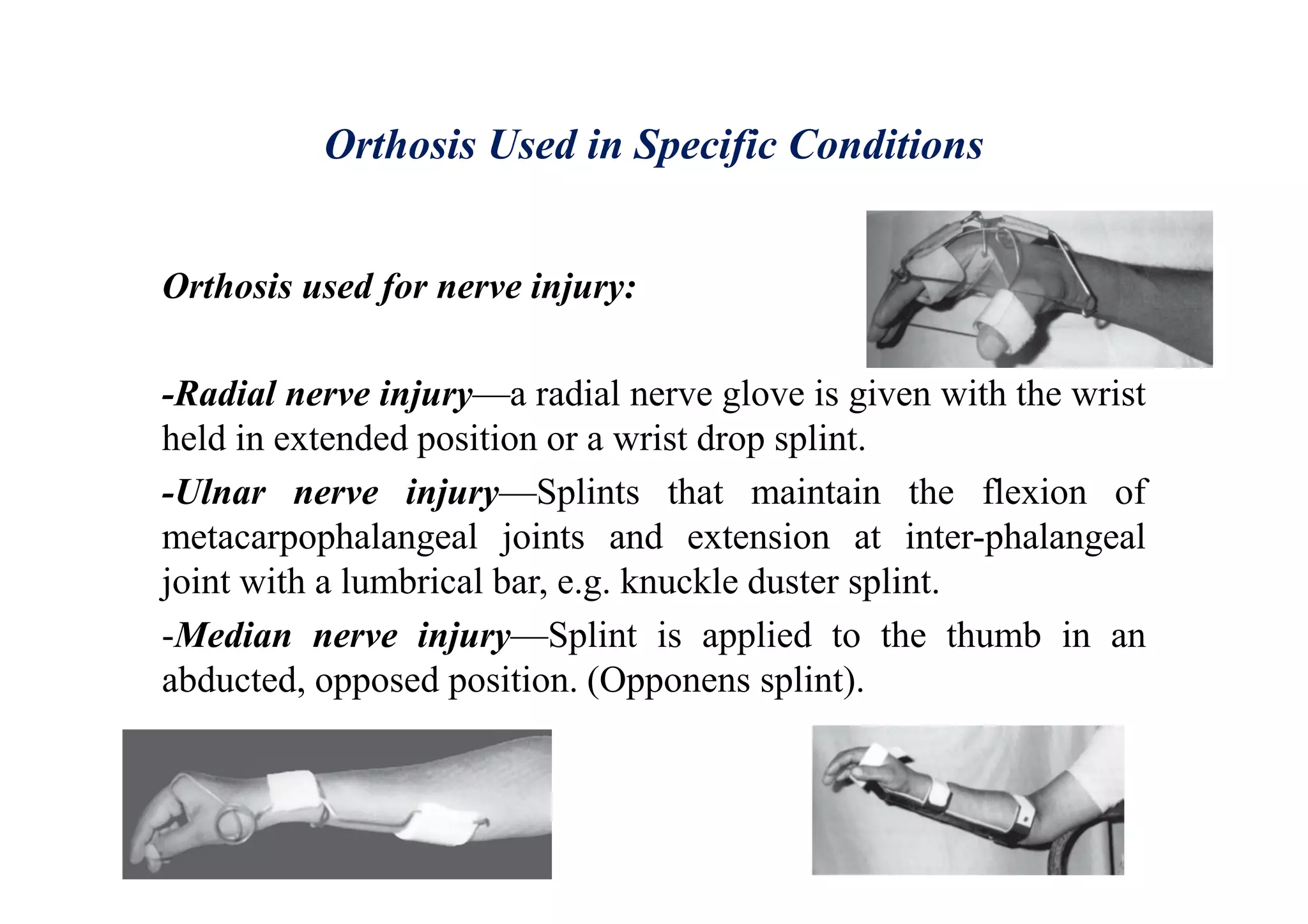 Orthosis Used in Specific Conditions
Orthosis used for nerve injury:
-Radial nerve injury—a radial nerve glove is given with the wrist
held in extended position or a wrist drop splint.
-Ulnar nerve injury—Splints that maintain the flexion of
metacarpophalangeal joints and extension at inter-phalangeal
joint with a lumbrical bar, e.g. knuckle duster splint.
-Median nerve injury—Splint is applied to the thumb in an
abducted, opposed position. (Opponens splint).
 