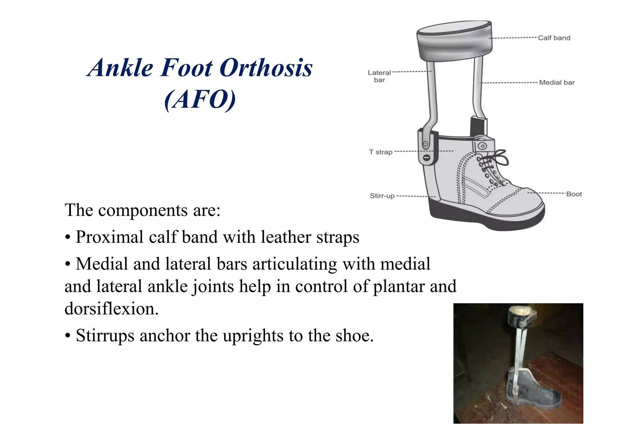 Ankle Foot Orthosis
(AFO)
The components are:
• Proximal calf band with leather straps
• Medial and lateral bars articulating with medial
and lateral ankle joints help in control of plantar and
dorsiflexion.
• Stirrups anchor the uprights to the shoe.
 