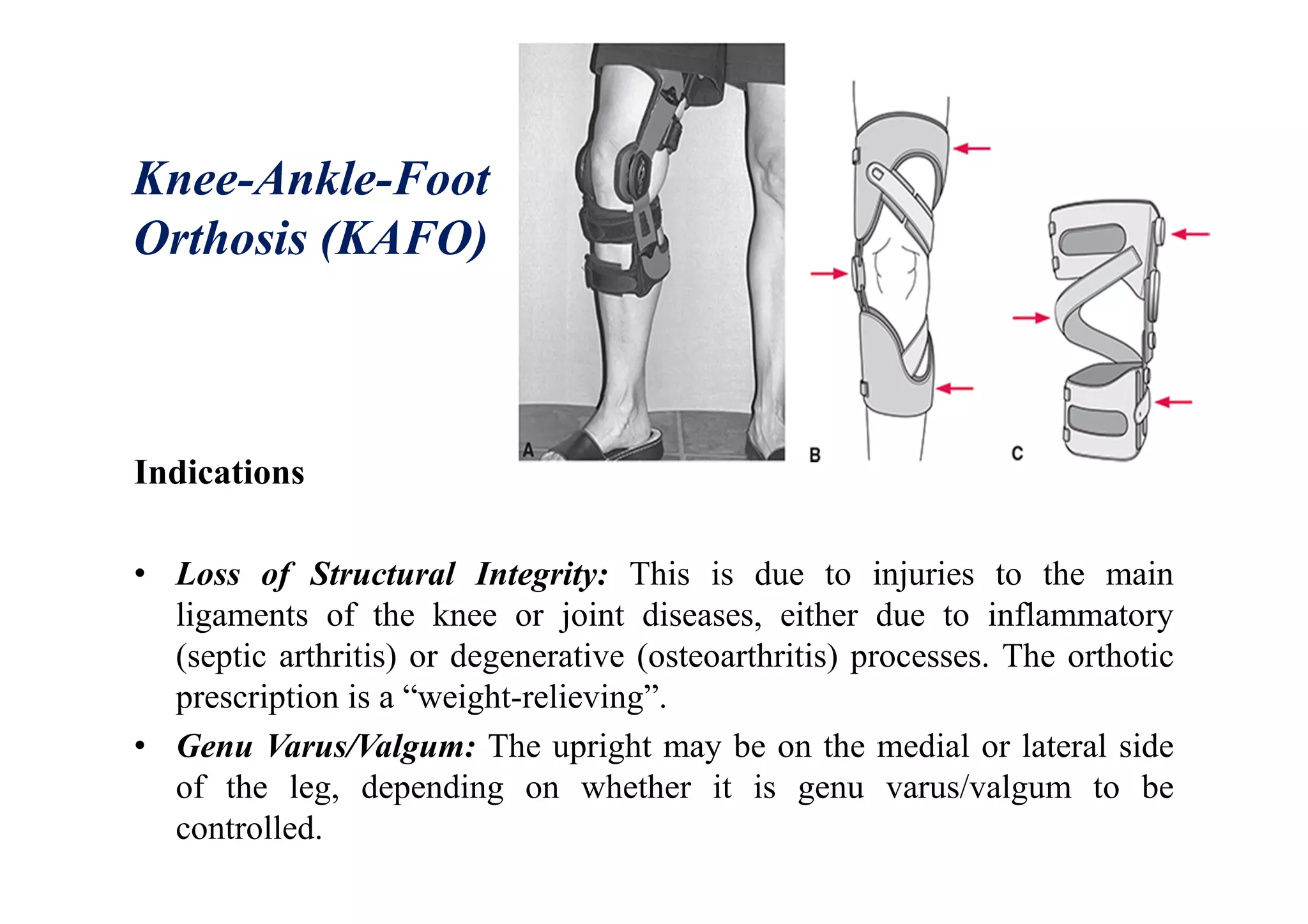 Knee-Ankle-Foot
Orthosis (KAFO)
Indications
• Loss of Structural Integrity: This is due to injuries to the main
ligaments of the knee or joint diseases, either due to inflammatory
(septic arthritis) or degenerative (osteoarthritis) processes. The orthotic
prescription is a “weight-relieving”.
• Genu Varus/Valgum: The upright may be on the medial or lateral side
of the leg, depending on whether it is genu varus/valgum to be
controlled.
 