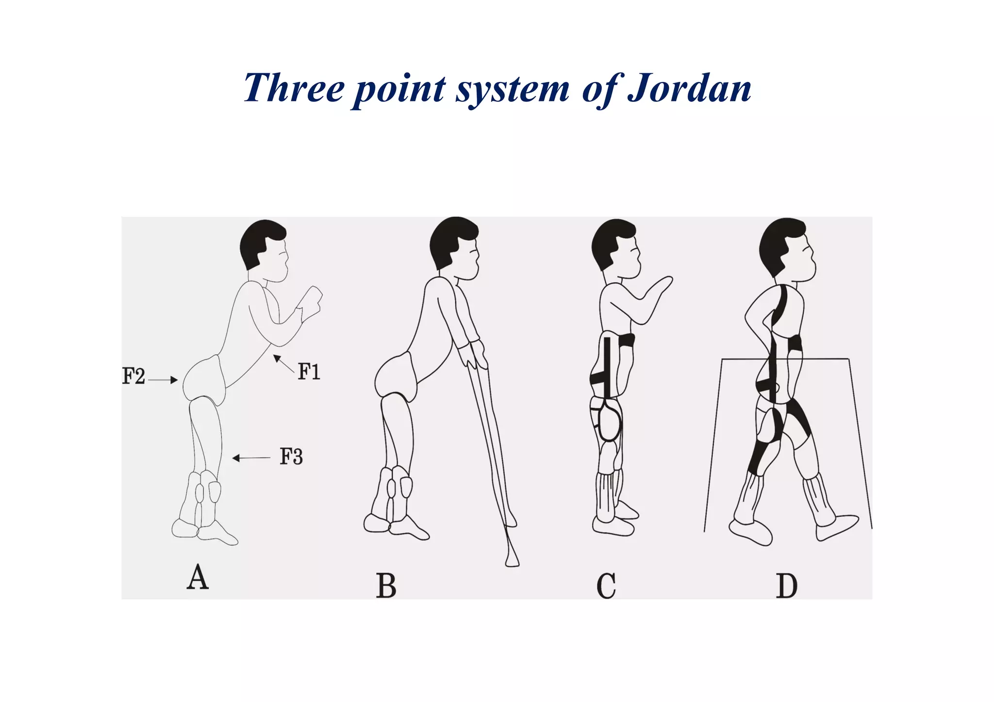 Three point system of Jordan
 