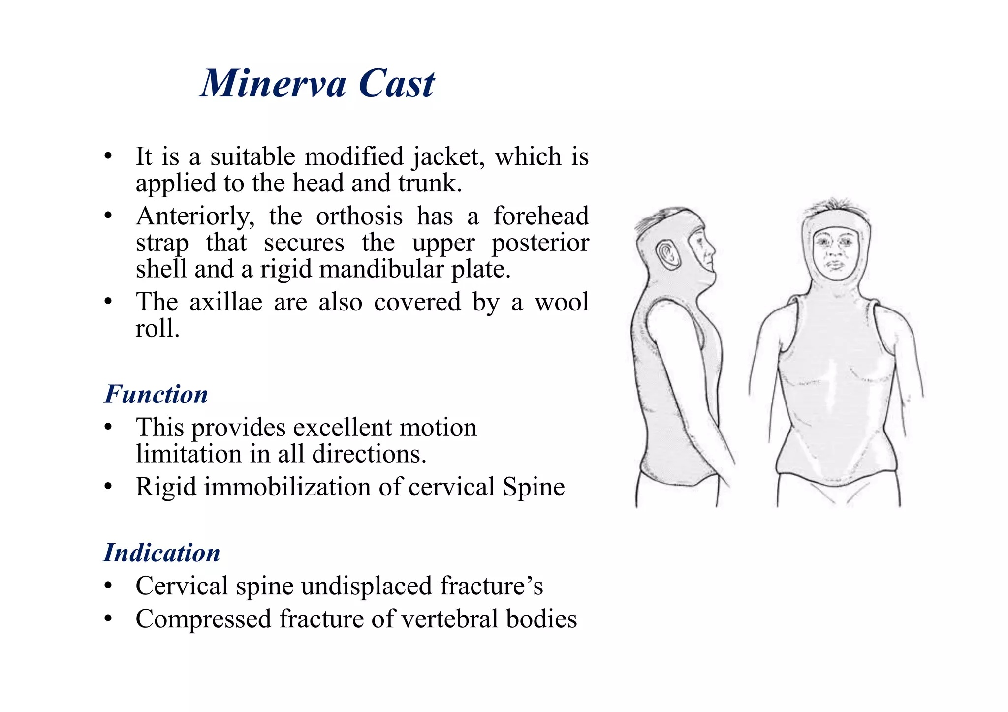 Minerva Cast
• It is a suitable modified jacket, which is
applied to the head and trunk.
• Anteriorly, the orthosis has a forehead
strap that secures the upper posterior
shell and a rigid mandibular plate.
• The axillae are also covered by a wool
roll.
Function
• This provides excellent motion
limitation in all directions.
• Rigid immobilization of cervical Spine
Indication
• Cervical spine undisplaced fracture’s
• Compressed fracture of vertebral bodies
 