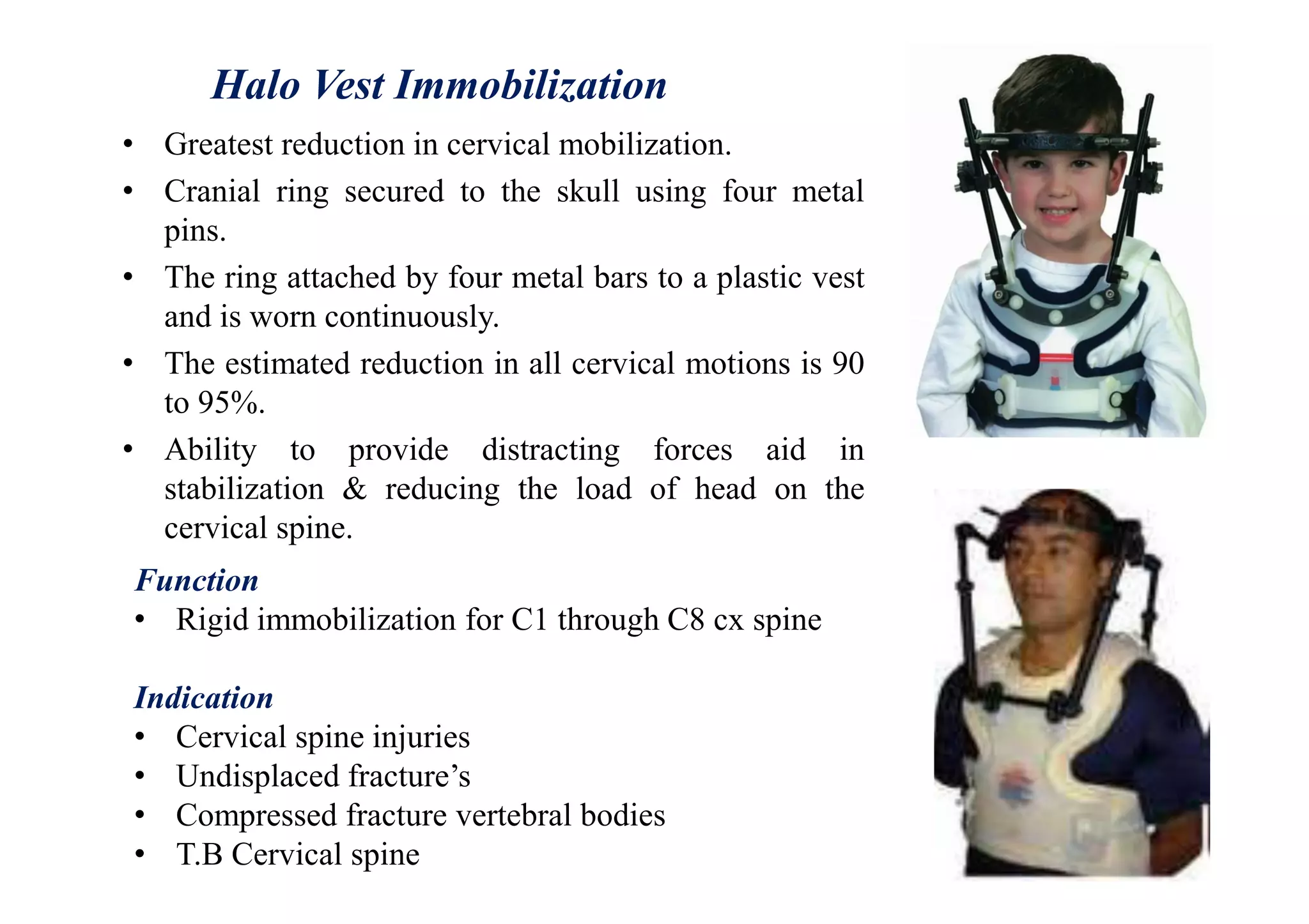 Halo Vest Immobilization
• Greatest reduction in cervical mobilization.
• Cranial ring secured to the skull using four metal
pins.
• The ring attached by four metal bars to a plastic vest
and is worn continuously.
• The estimated reduction in all cervical motions is 90
to 95%.
• Ability to provide distracting forces aid in
stabilization & reducing the load of head on the
cervical spine.
Function
• Rigid immobilization for C1 through C8 cx spine
Indication
• Cervical spine injuries
• Undisplaced fracture’s
• Compressed fracture vertebral bodies
• T.B Cervical spine
 