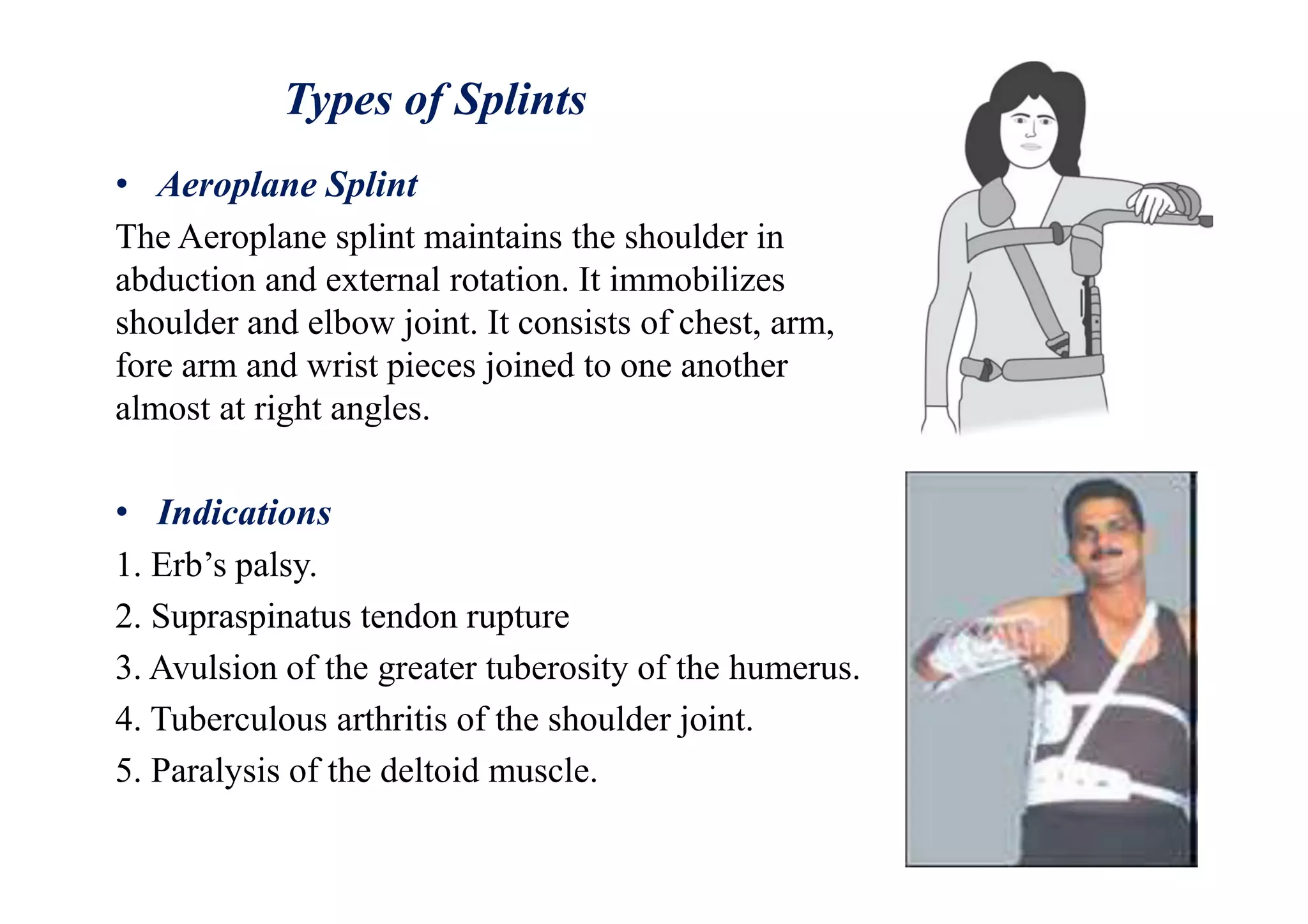 Types of Splints
• Aeroplane Splint
The Aeroplane splint maintains the shoulder in
abduction and external rotation. It immobilizes
shoulder and elbow joint. It consists of chest, arm,
fore arm and wrist pieces joined to one another
almost at right angles.
• Indications
1. Erb’s palsy.
2. Supraspinatus tendon rupture
3. Avulsion of the greater tuberosity of the humerus.
4. Tuberculous arthritis of the shoulder joint.
5. Paralysis of the deltoid muscle.
 