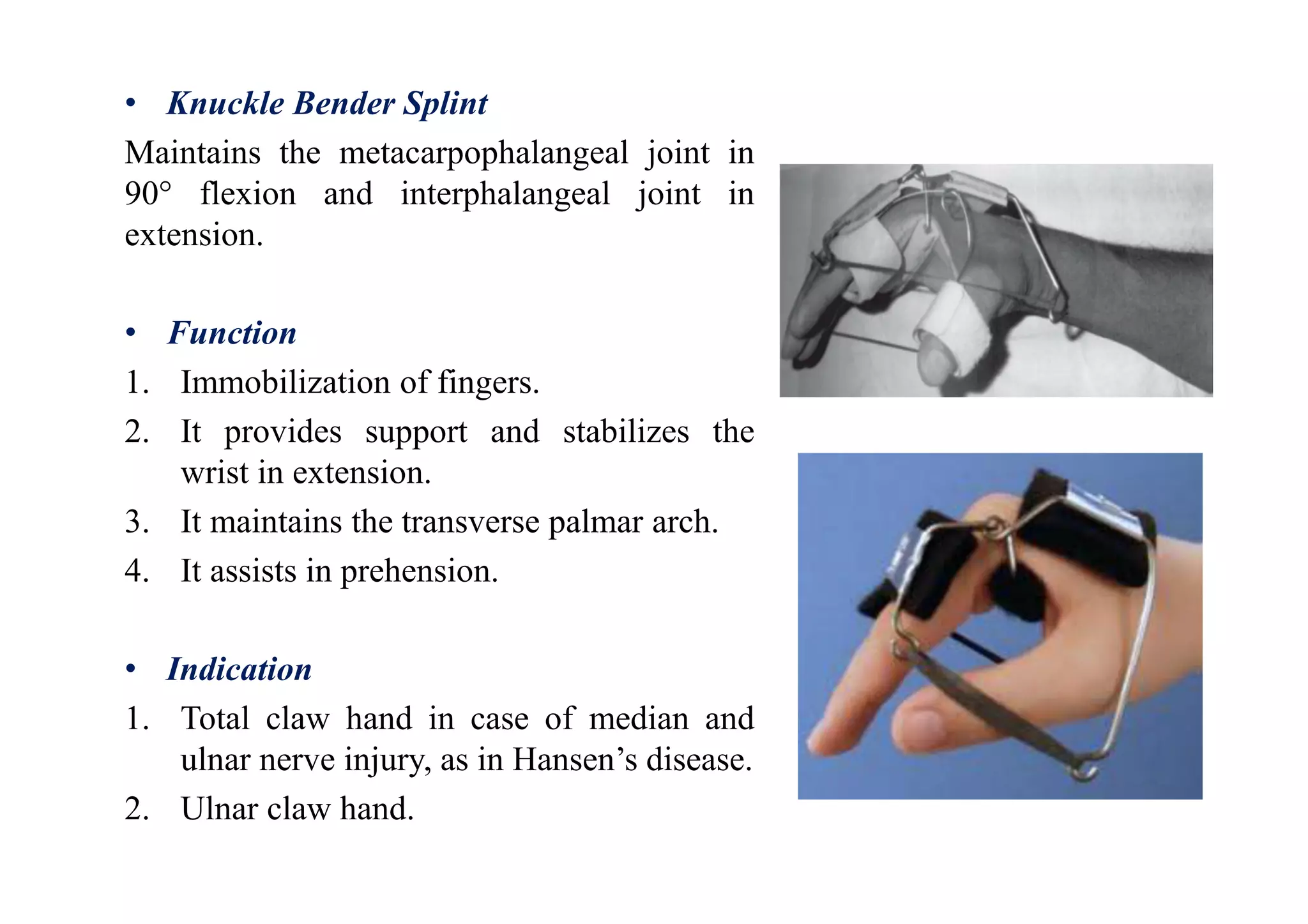 • Knuckle Bender Splint
Maintains the metacarpophalangeal joint in
90° flexion and interphalangeal joint in
extension.
• Function
1. Immobilization of fingers.
2. It provides support and stabilizes the
wrist in extension.
3. It maintains the transverse palmar arch.
4. It assists in prehension.
• Indication
1. Total claw hand in case of median and
ulnar nerve injury, as in Hansen’s disease.
2. Ulnar claw hand.
 