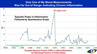 Only One of My Blood Measurements
Was Far Out of Range--Indicating Chronic Inflammation
Normal Range <1 mg/L
27x Upper Limit
Complex Reactive Protein (CRP) is a Blood Biomarker
for Detecting Presence of Inflammation
Episodic Peaks in Inflammation
Followed by Spontaneous Drops
 