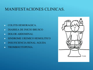MANIFESTACIONES CLINICAS.
▶ COLITIS HEMORAGICA.
▶ DIARREA DE INICIO BRUSCO
▶ DOLOR ABDOMINAL
▶ SINDROME UREMICO HEMOLITICO
▶ INSUFICIENCIA RENAL AGUDA
▶ TROMBOCITOPENIA.
 