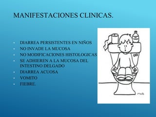 MANIFESTACIONES CLINICAS.
• DIARREA PERSISTENTES EN NIÑOS
• NO INVADE LA MUCOSA
• NO MODIFICACIONES HISTOLOGICAS
• SE ADHIEREN A LA MUCOSA DEL
INTESTINO DELGADO
• DIARREA ACUOSA
• VOMITO
• FIEBRE.
 