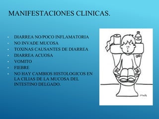 MANIFESTACIONES CLINICAS.
• DIARREA NO/POCO INFLAMATORIA
• NO INVADE MUCOSA
• TOXINAS CAUSANTES DE DIARREA
• DIARREA ACUOSA
• VOMITO
• FIEBRE
• NO HAY CAMBIOS HISTOLOGICOS EN
LA CILIAS DE LA MUCOSA DEL
INTESTINO DELGADO.
 