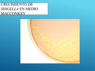 CRECIMIENTO DE
SHIGELLA EN MEDIO
MACCONKEY
 