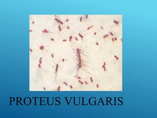 PROTEUS VULGARIS
 