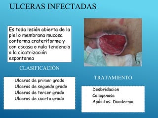 ULCERAS INFECTADAS
CLASIFICACIÓN
▣ Ulceras de primer grado
▣ Ulceras de segundo grado
▣ Ulceras de tercer grado
▣ Ulceras de cuarto grado
TRATAMIENTO
▣ Desbridacion
▣ Colagenasa
▣ Apósitos: Duodermo
Es toda lesión abierta de la
piel o membrana mucosa
conforma crateriforme y
con escasa o nula tendencia
a la cicatrización
espontanea
 